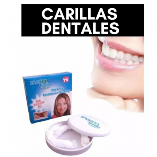 Carillas Dentales